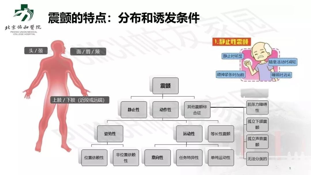 手抖就是帕金森病嗎？臨床常見的 4 個誤區(qū)